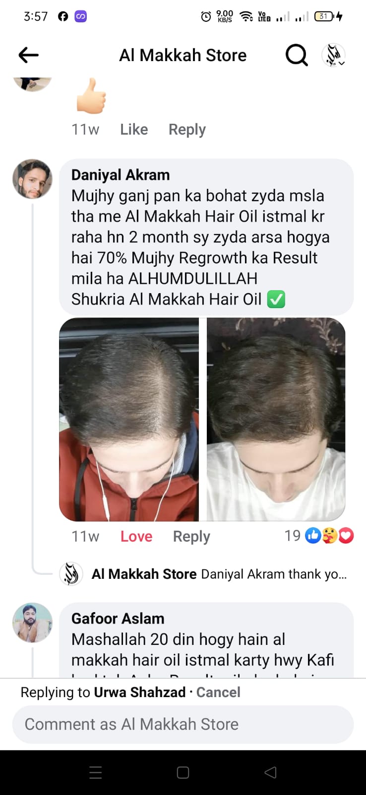 Onion Hair Oil ( Pack of 2)
